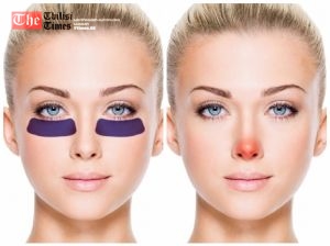 ავადმყოფობის 13 მინიშნება, რომელიც სახეზე გაწერიათ