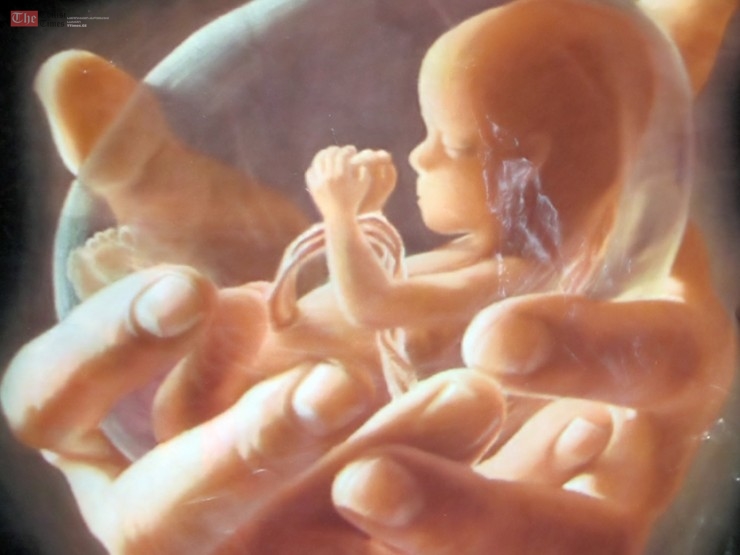 სამინისტრო ორსულობის ულტრასონოგრაფიული მონიტორინგის პროტოკოლზე მუშაობს – ჯანდაცვის სამინისტრო