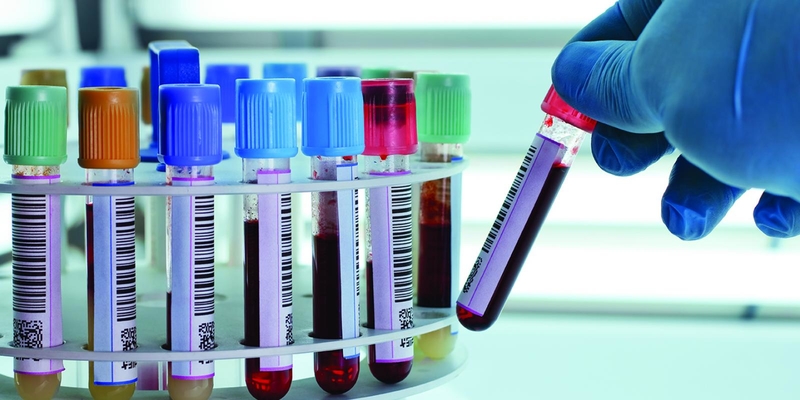 კვლევა: ახალი ტესტი კიბოს 20-ზე მეტ სახეობას დაადგენს