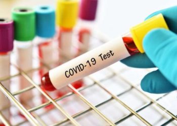 ექიმი გვაფრთხილებს: შესაძლოა იყოთ კოვიდდადებითი და ტესტმა უარყოფითი აჩვენოს