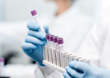 კორონავირუსის 1862 ახალი შემთხვევა და 11 გარდაცვალება – ინფიცირების მაჩვენებელი მკვეთრად გაიზარდა