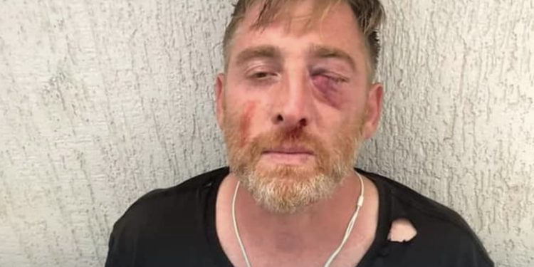 ტვ პირველის ოპერატორი ლექსო ლაშქარავა, რომელსაც 5 ივლისს სასტიკად სცემეს, გარდაიცვალა