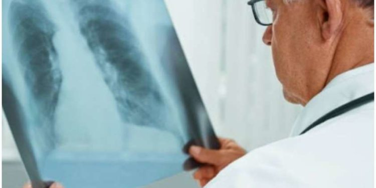 ექიმებმა კიბოს უჩვეულო სიმპტომი დაასახელეს