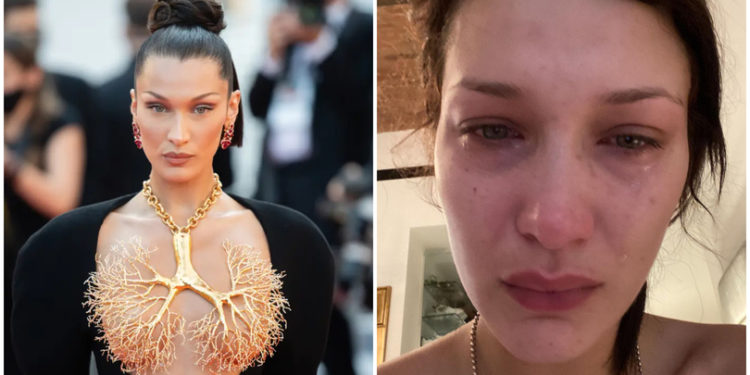 სოციალური მედია ყალბია — ბელა ჰადიდმა მენტალურ ჯანმრთელობაზე ილაპარაკა