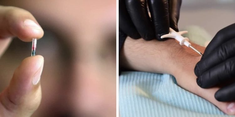 საქართველოში შვედეთის შემდეგ პირველად, დაინერგება ჩიპის ტექნოლოგია