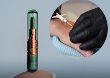 კანქვეშა ჩიპები საქართველოში ხელმისაწვდომი მომავალი წლიდან იქნება