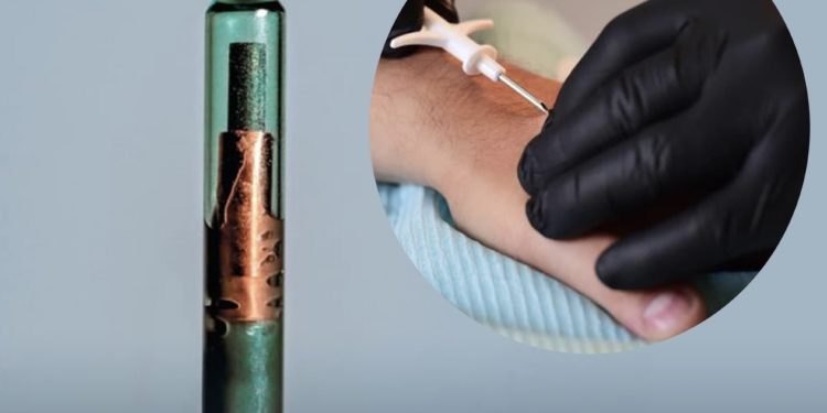 კანქვეშა ჩიპები საქართველოში ხელმისაწვდომი მომავალი წლიდან იქნება