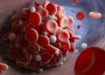 მეცნიერები – COVID-19-ის აცრის შემდეგ თრომბის ჩამოყალიბების მიზეზი დადგენილია