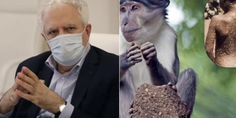 მაიმუნის ყვავილის ვირუსის 2-3 საათში სადიაგნოსტიკოდ მალე სპეციალური „პისიარ ტესტი“ გვექნება – გამყრელიძე