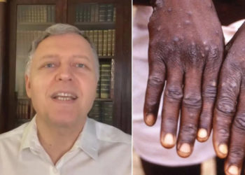 „ეს ვაქცინა 85 პროცენტით იცავს“ – გიორგი ფხაკაძემ დაასახელა ვაქცინა, მაიმუნის ყვავილის თავდასაცავად