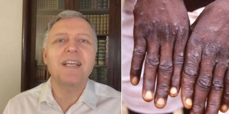 „ეს ვაქცინა 85 პროცენტით იცავს“ – გიორგი ფხაკაძემ დაასახელა ვაქცინა, მაიმუნის ყვავილის თავდასაცავად