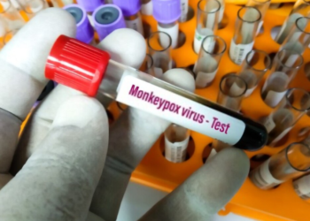 რა უნდა იცოდეთ „მაიმუნის ყვავილის“ შესახებ და როგორ ავიცილოთ ეს ვირუსი თავიდან?  