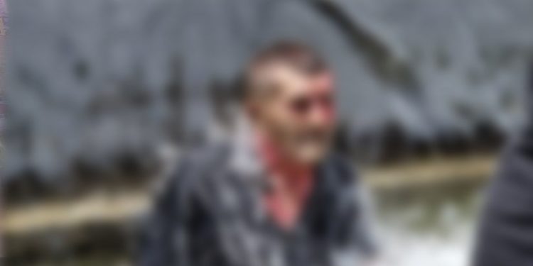 პარლამენტთან, აქციის მონაწილემ თავის დაწვა სცადა