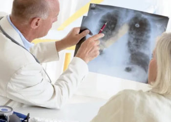 მორიგი სენსაციური მიღწევა – ფილტვის კიბოს ყველაზე საშიში ფორმის განკურნება შესაძლებელია