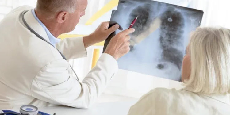 მორიგი სენსაციური მიღწევა – ფილტვის კიბოს ყველაზე საშიში ფორმის განკურნება შესაძლებელია