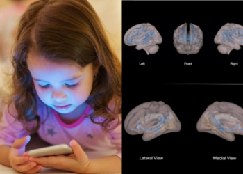 ბავშვებს, რომლებიც ეკრანთან საათზე მეტს ატარებენ, ტვინის თეთრი ნივთიერება ნაკლებად აქვთ განვითარებული – კვლევის საგანგაშო შედეგები