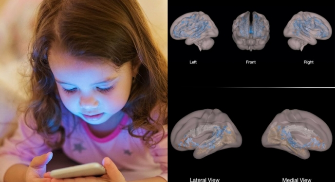 ბავშვებს, რომლებიც ეკრანთან საათზე მეტს ატარებენ, ტვინის თეთრი ნივთიერება ნაკლებად აქვთ განვითარებული – კვლევის საგანგაშო შედეგები