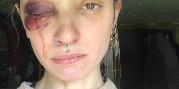 ცოლზე ძალადობაში ბრალდებული დააკავეს და ბრალი წარუდგინეს – პროკურატურა