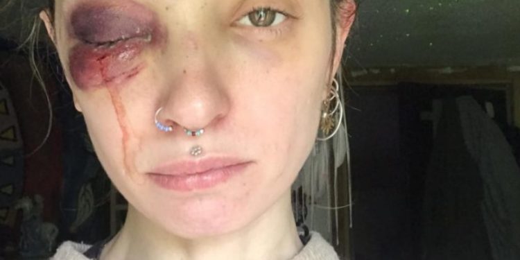 რენატა ბეგიაშვილზე ფიზიკურ ძალადობაში ბრალდებული სასამართლომ 50 000-ლარიანი გირაოთი გაათავისუფლა