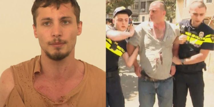 ხეჩინაშვილის კლინიკაში მომხდარ ინციდენტზე გამოძიება პოლიციელისთვის წინააღმდეგობის გაწევის მუხლით დაიწყო