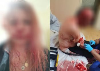 მეზობელი მამა-შვილს სახლში შეუვარდა და სასტიკად გაუსწორდა