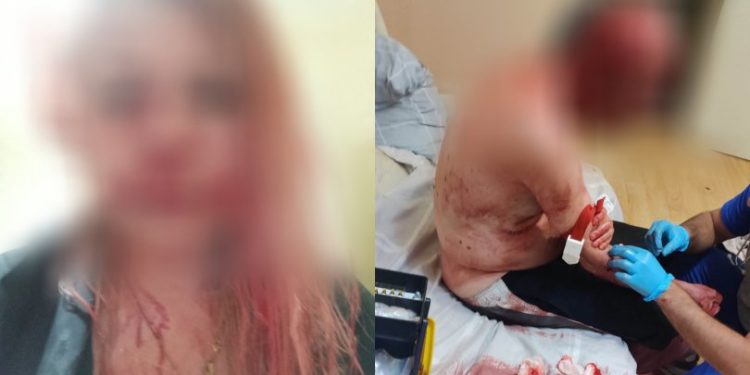 მეზობელი მამა-შვილს სახლში შეუვარდა და სასტიკად გაუსწორდა