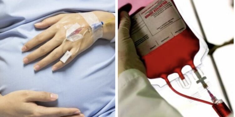 „სასწრაფოდ გვჭირდება რეზუს უარყოფითი პირველი ჯგუფის სისხლი“ – 18 წლის გოგოს მშობიარობა გაურთულდა და კომაშია