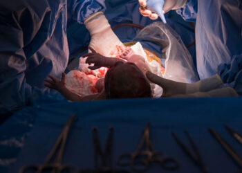 საკეისრო კვეთის ყურების შემდეგ, მშობიარეს ქმარი კლინიკისგან მილიარდს ითხოვს