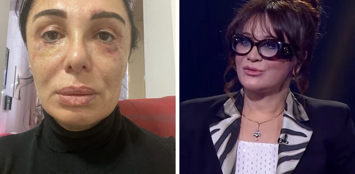 “კიდევ ორი ოპერაციაა საჭირო იმისთვის, რომ სახე აღვიდგინო“ – ვინ და რატომ უჩივის ციცინო შურღაიას?