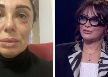 “კიდევ ორი ოპერაციაა საჭირო იმისთვის, რომ სახე აღვიდგინო“ – ვინ და რატომ უჩივის ციცინო შურღაიას?