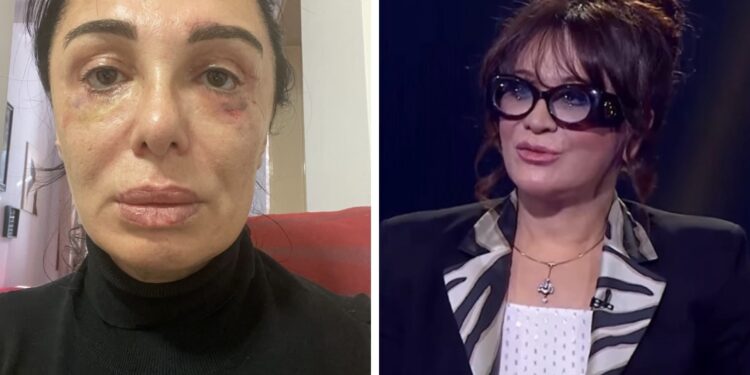 “კიდევ ორი ოპერაციაა საჭირო იმისთვის, რომ სახე აღვიდგინო“ – ვინ და რატომ უჩივის ციცინო შურღაიას?