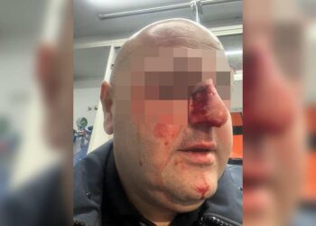 პარლამენტთან მიმდინარე აქციაზე პოლიციელს ბლაგვი საგნით ფიზიკური დაზიანება მიაყენეს