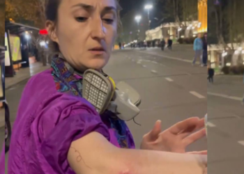 სპეცრაზმელებმა გადამიარეს, ხელი მოვიტეხე და ფეხზე ჭრილობა მაქვს – მარიამ დოლიძეს ოპერაციისთვის ამზადებენ