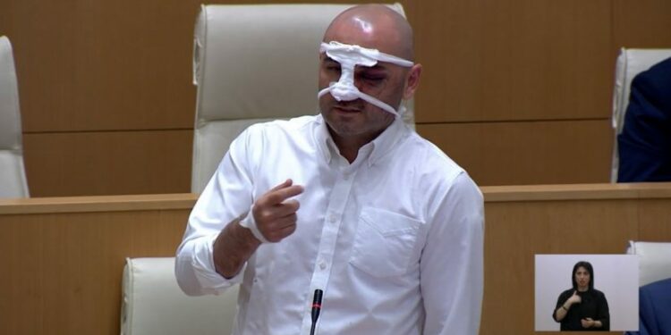 იძახოდნენ, რომ „მოკალით და მერე თქვით, რომ თავი დაარტყა“ – ხაბეიშვილი სპეცრაზმელებზე