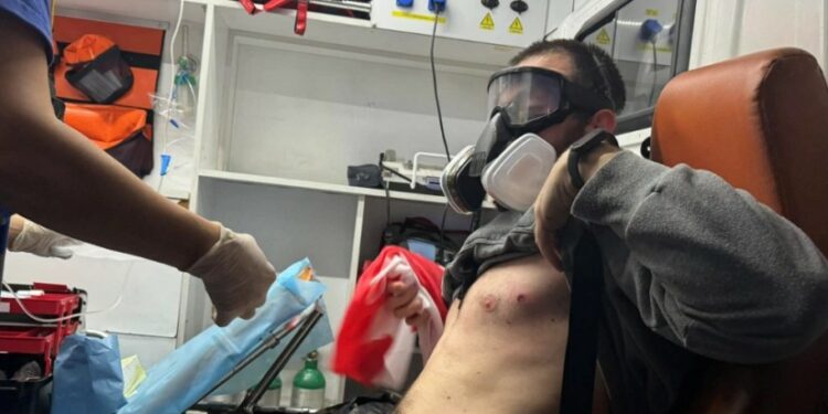 ჩიტაძის ქუჩაზე სამართალდამცველებმა სავარაუდოდ, რეზინის ტყვიები და წიწაკის სპრეი გამოიყენეს – არიან დაშავებულები