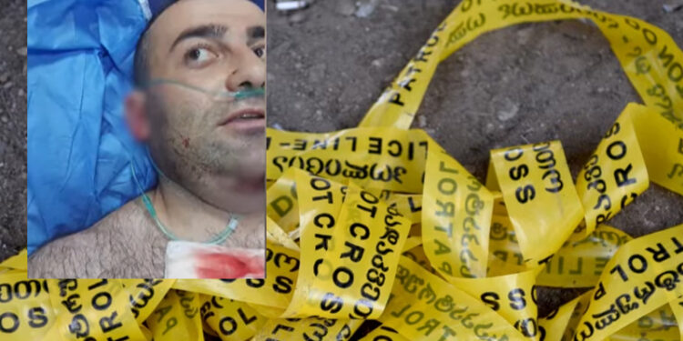 სისხლიანი ანგარიშსწორება მარტვილში – ვინ არიან თავდამსხმელები და რა გახდა ძმების დაჭრის მიზეზი?