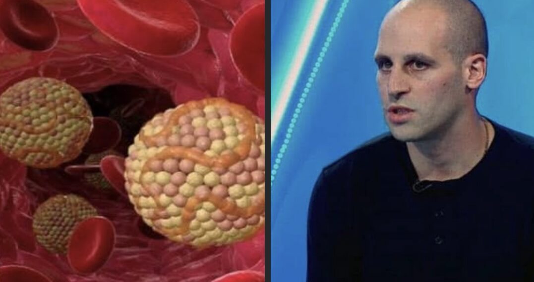 “ჩუმი მკვლელი” – ზაზა თელია ქოლესტერინის მაღალი დონის გარეგნული სიმპტომების შესახებ საუბრობს