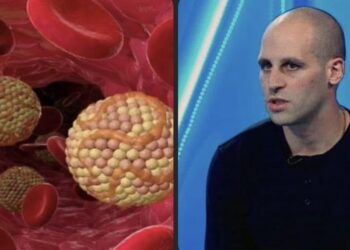 “ჩუმი მკვლელი” – ზაზა თელია ქოლესტერინის მაღალი დონის გარეგნული სიმპტომების შესახებ საუბრობს