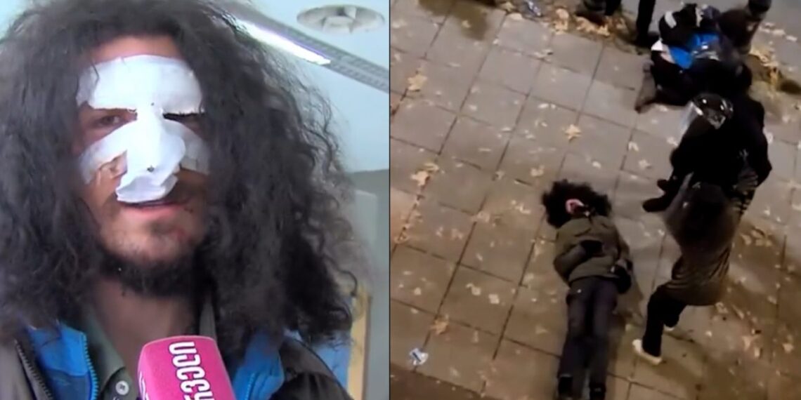 “მაგ კადრებში უკვე გათიშული ვიყავი..” – ზვიად მაისაშვილი