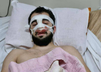 პოლიციელებმა აქციაზე სასტიკად ნაცემ ახალგაზრდას ნახმარი წინდა მისცეს სისხლის შესაჩერებლად – უფლებები საქართველო