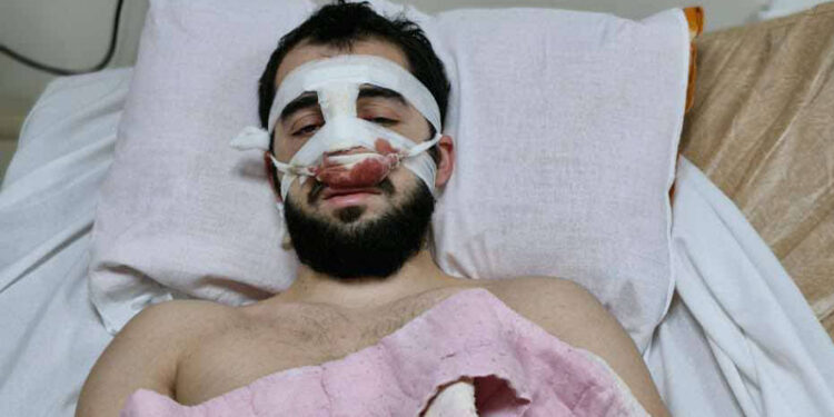 პოლიციელებმა აქციაზე სასტიკად ნაცემ ახალგაზრდას ნახმარი წინდა მისცეს სისხლის შესაჩერებლად – უფლებები საქართველო