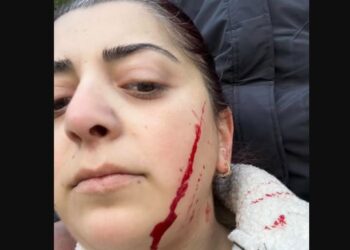 “გაა….ვი შენს ევროპაში” – ბოლნისში მასწავლებელი სამართებლით დაჭრეს