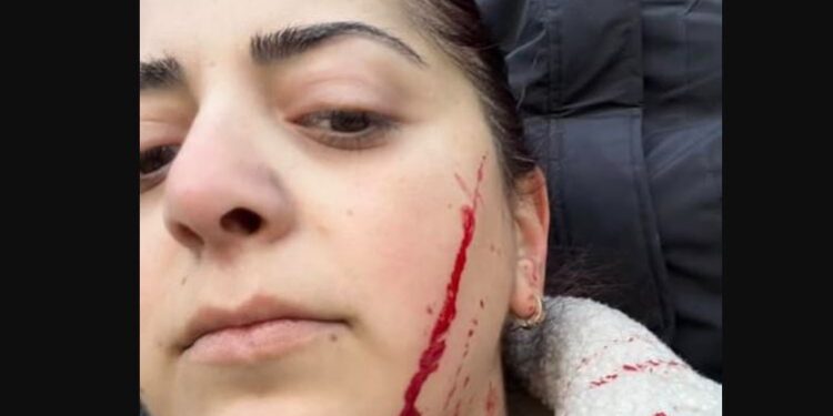 “გაა….ვი შენს ევროპაში” – ბოლნისში მასწავლებელი სამართებლით დაჭრეს