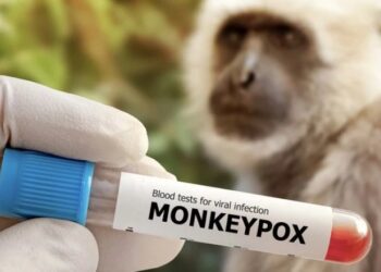 აზერბაიჯანში „მაიმუნის ყვავილით” ინფიცირების პირველი შემთხვევა დაფიქსირდა