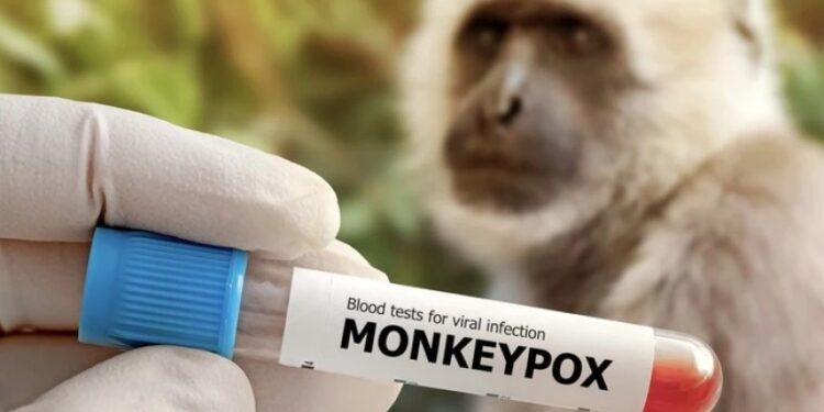 აზერბაიჯანში „მაიმუნის ყვავილით” ინფიცირების პირველი შემთხვევა დაფიქსირდა