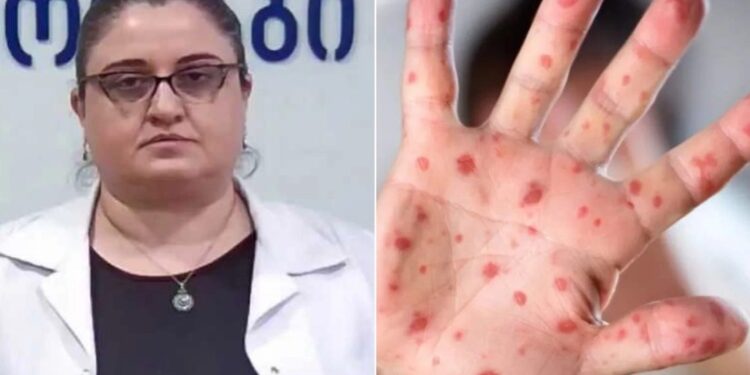 ინფექციონისტის საგანგებო მიმართვა