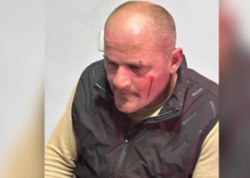 შუქრუთის მაღაროს დირექტორის ჯანმრთელობის მდგომარეობა დღეს დამძიმდა – მასზე თავდასხმიდან რამდენიმე საათში პოლიციამ 4 პირი დააკავა