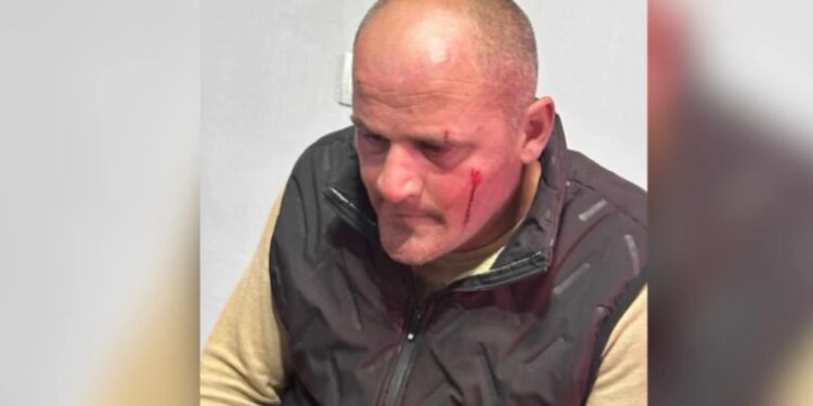 შუქრუთის მაღაროს დირექტორის ჯანმრთელობის მდგომარეობა დღეს დამძიმდა – მასზე თავდასხმიდან რამდენიმე საათში პოლიციამ 4 პირი დააკავა