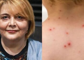 ,,მუნის ორი შემთხვევა დაფიქსირდა…” – რას ამბობს ცნობილი პედიატრი და როგორ უნდა დავიცვათ თავი