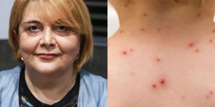 ,,მუნის ორი შემთხვევა დაფიქსირდა…” – რას ამბობს ცნობილი პედიატრი და როგორ უნდა დავიცვათ თავი